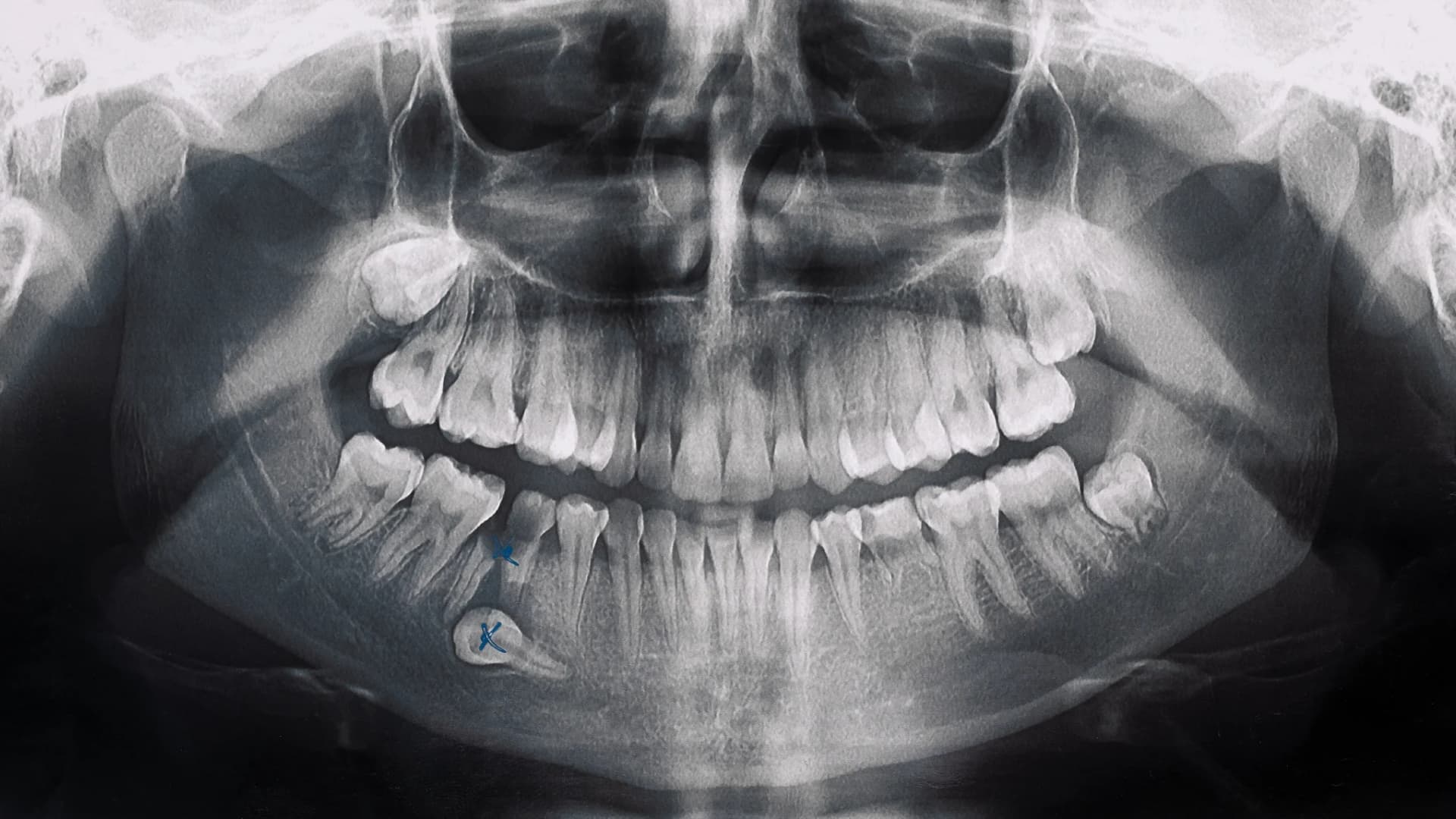Centro radiológico dental Odontokinética