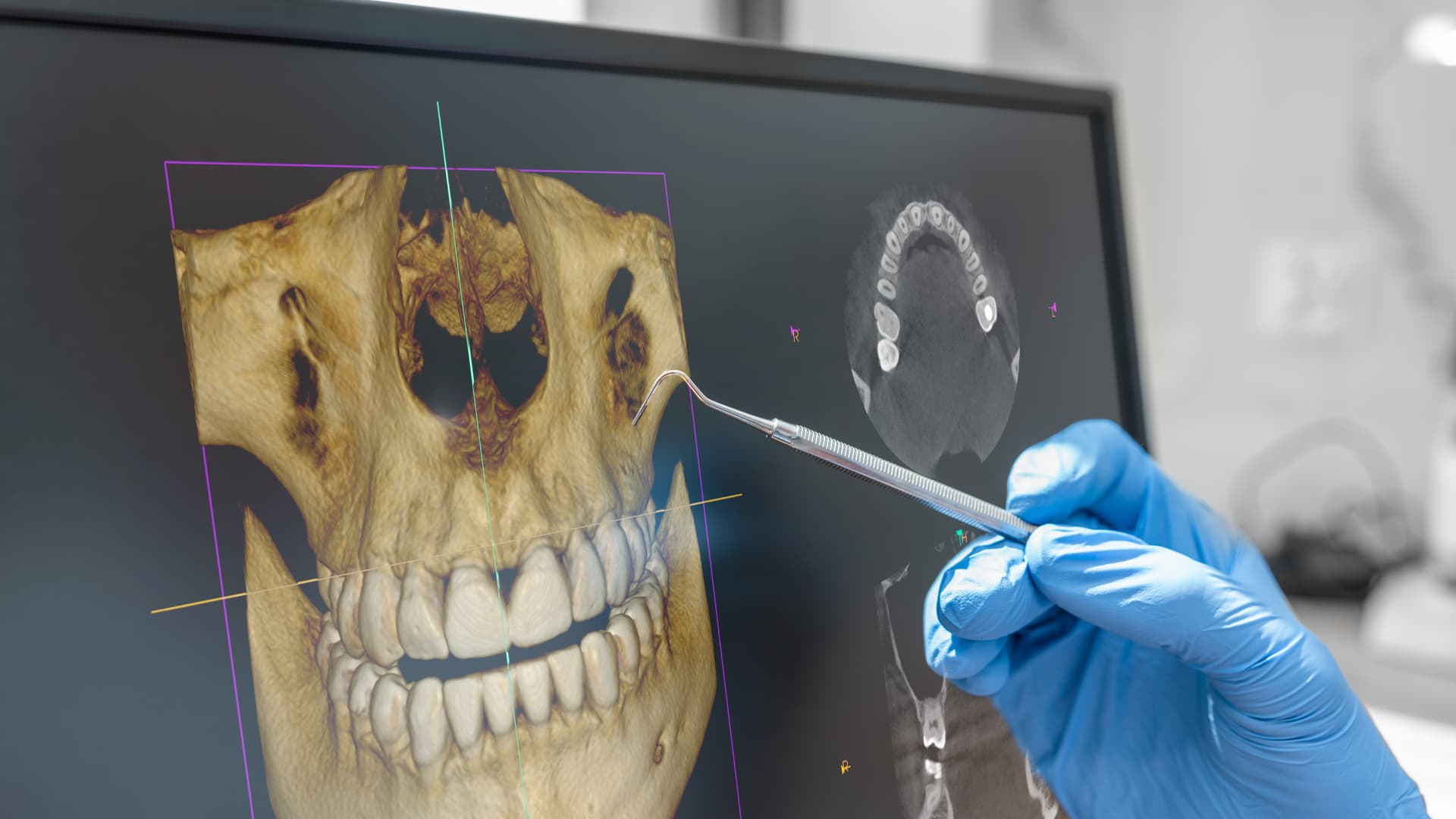 Radiografía panorámica dental Odontokinética