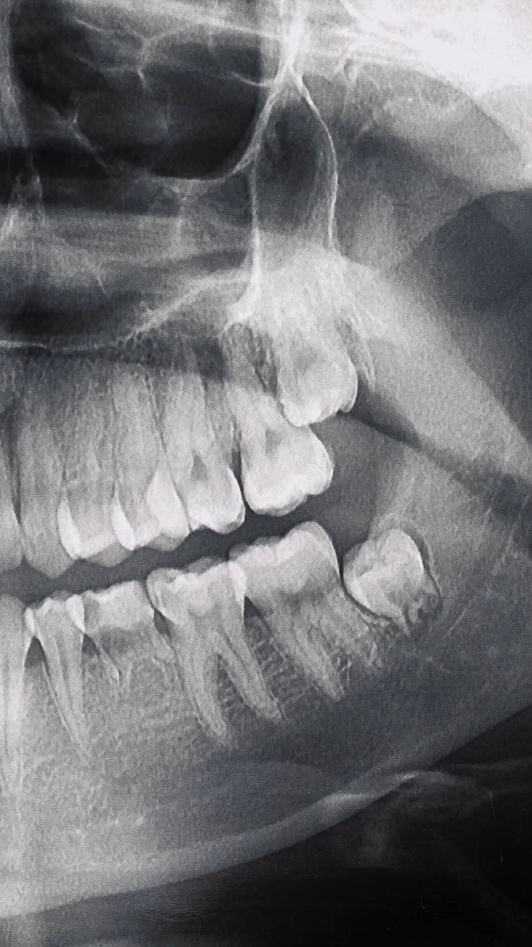 Radiografía dental - Tecnología de precisión Odontokinetica