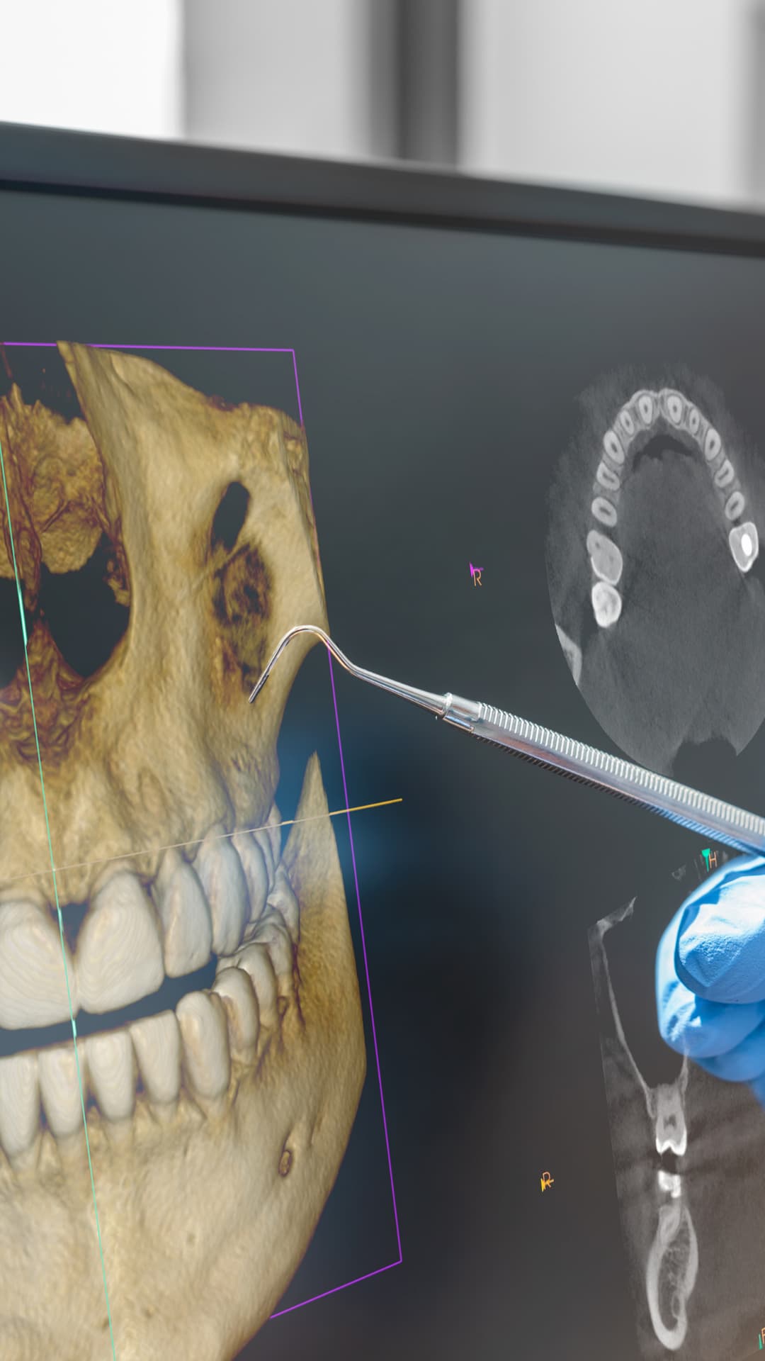 Radiografía panorámica dental Odontokinética