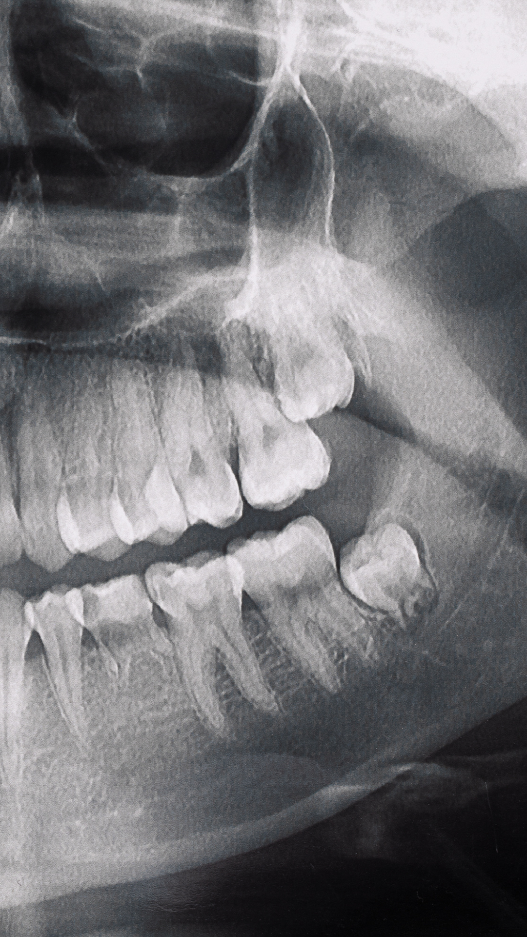 Radiografía dental - Tecnología de precisión Odontokinetica