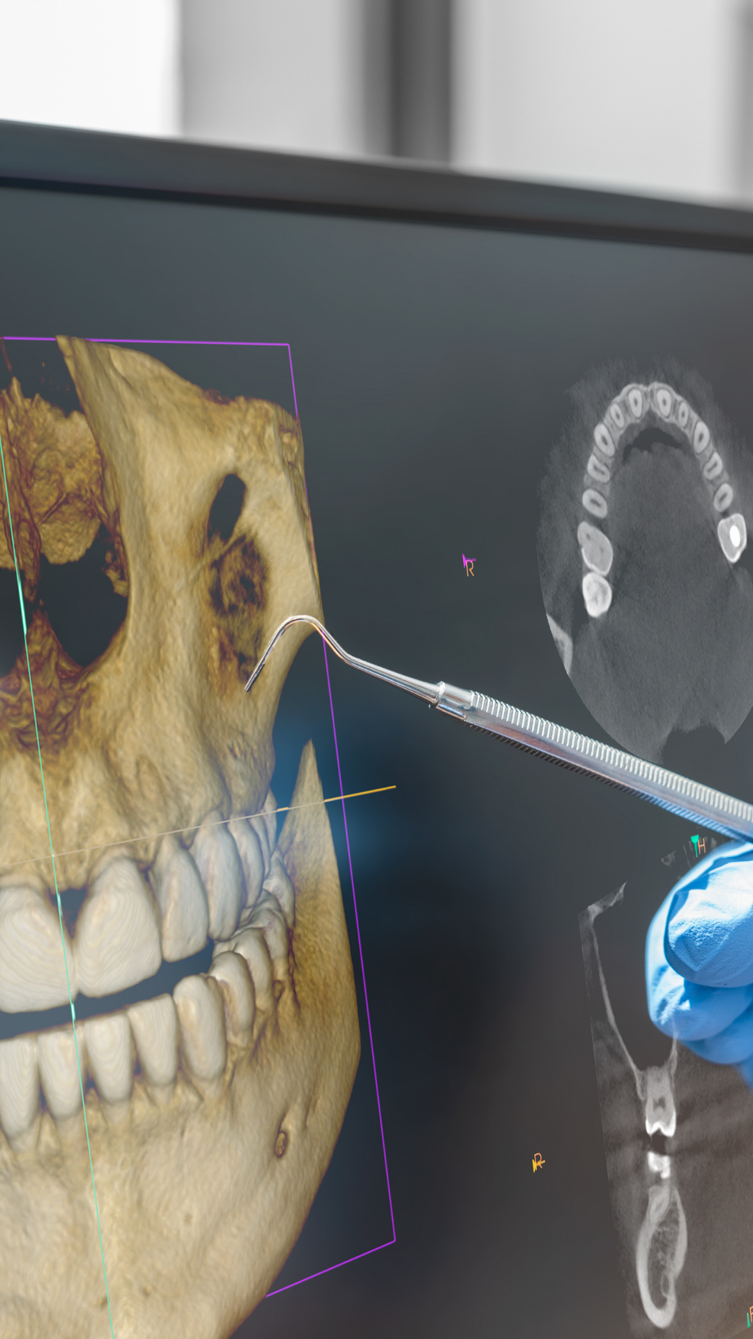 Equipo radiológico avanzado - Odontokinetica