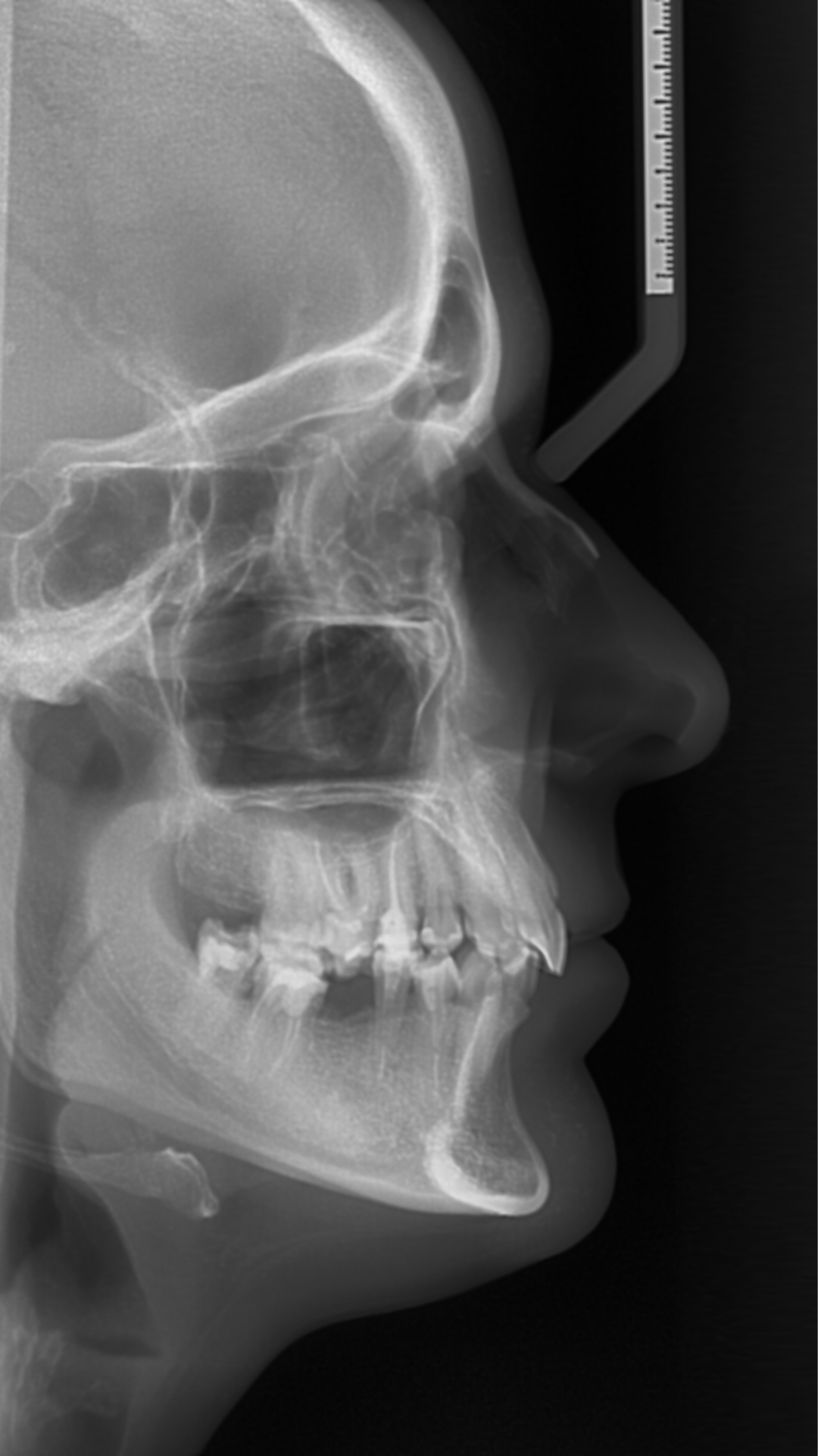 Especialista Odontokinetica Supervisando